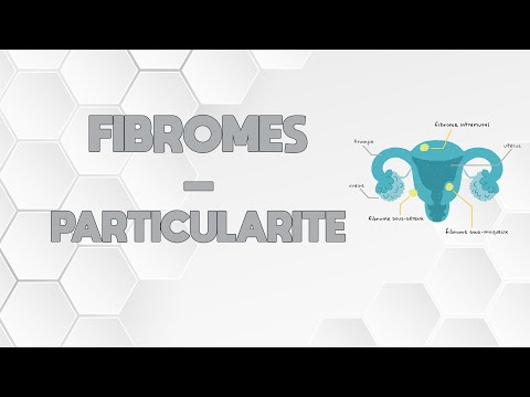 LES FIBROMES - PARTICULARITÉ DES FEMMES