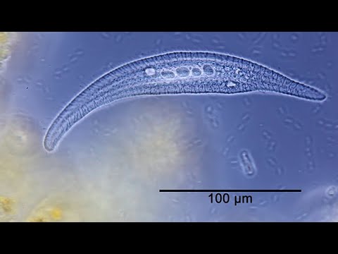 Wimpertierchen Litonotus crystallinus