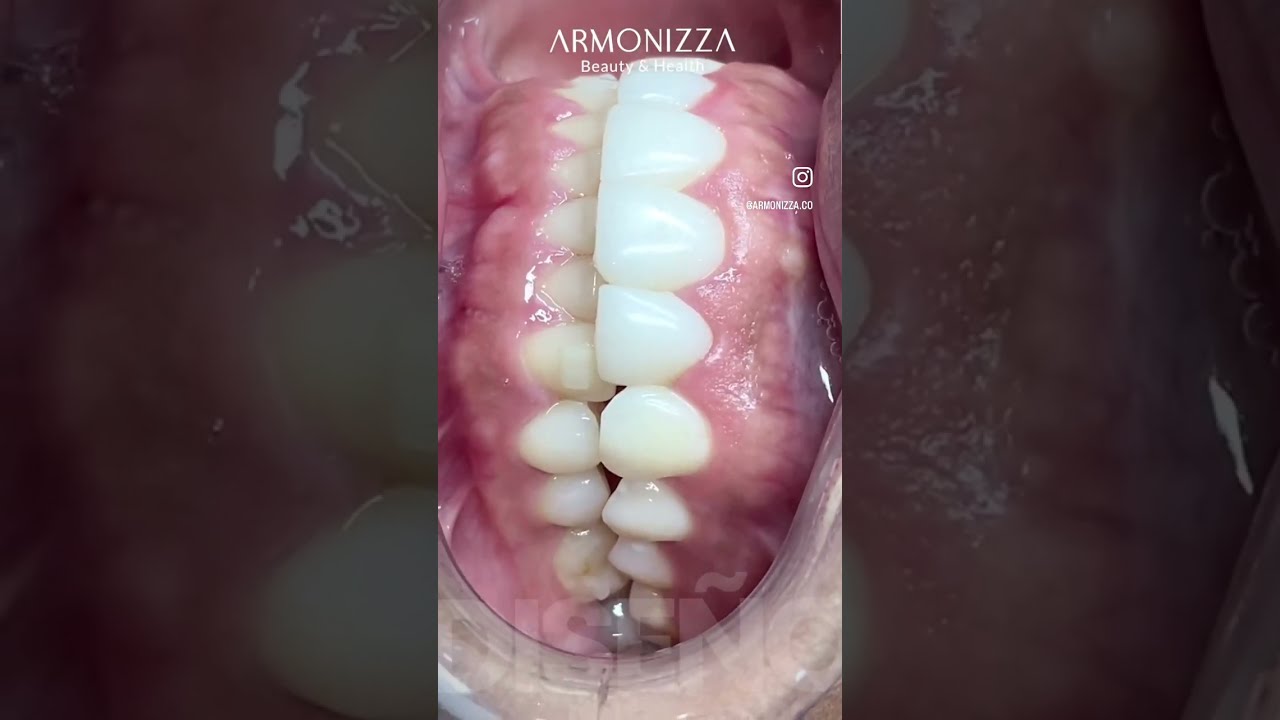 Johanna Sepúlveda-23