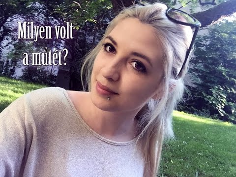 visszér válaszok és kérdések