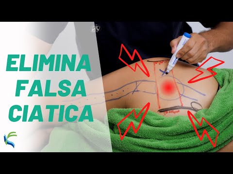 Eliminate false SCIATICA ⚡ with these EXERCISES 💪😍 Fisiolution