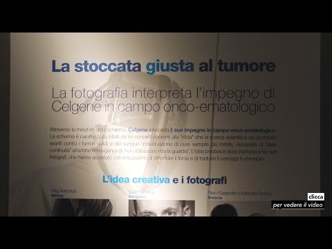Che calmare nervi a neurodermatitis Sanatori di dermatite di Yevpatoria atopic