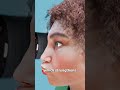 The Video Game That Helps Lazy Eye 😳