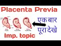 Placenta Previa in hindi