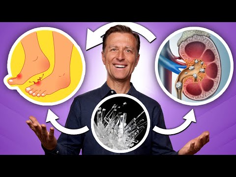 The Top SUPERFOODS for the Kidneys—Explained by Dr Berg