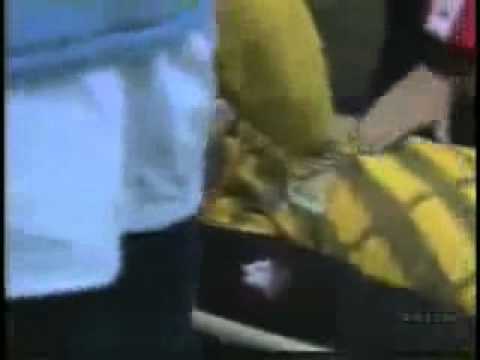 Milan-Roma 1987/88 Tancredi colpito