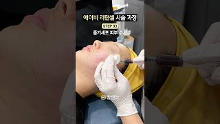 줄기세포 스킨부스터 찐 과정 👀