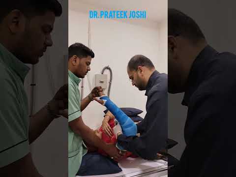 Elbow fracture Fiberglass Cast Plaster Application | Dr. Prateek Joshi #shorts #elbow #plaster #cast