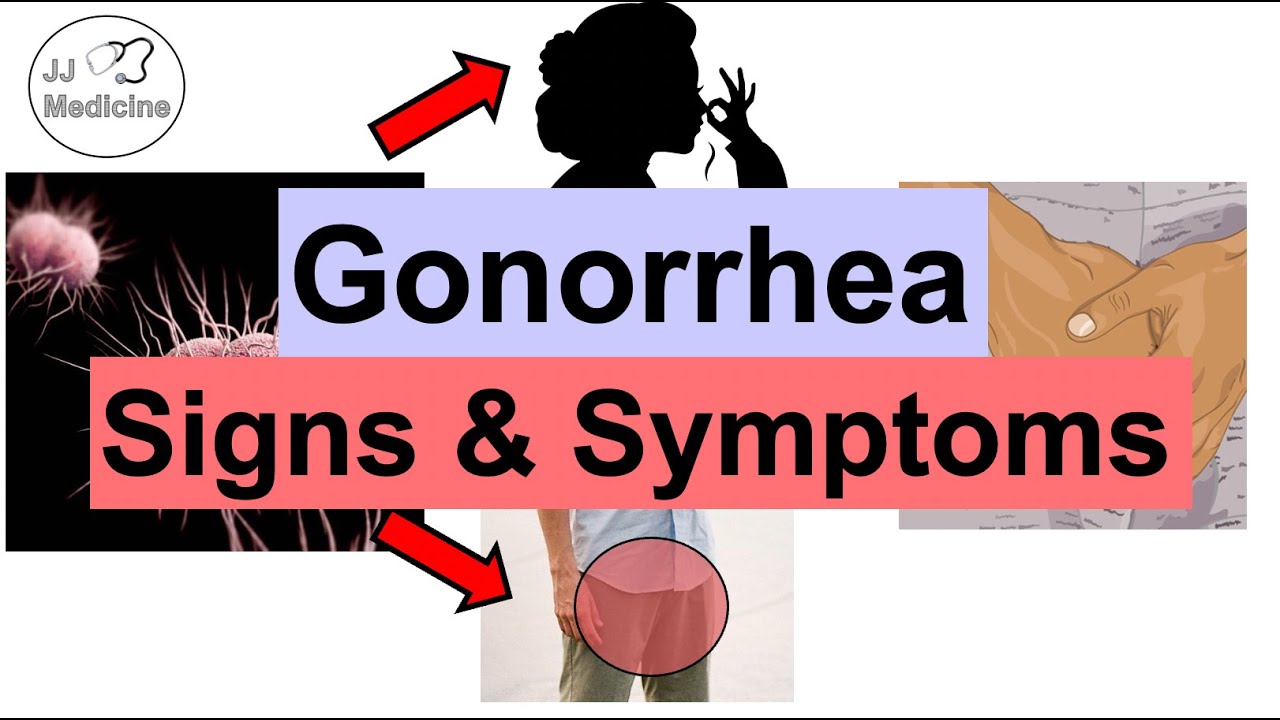 Gonorrhea Signs and Symptoms & Complications (& Why They Occur)