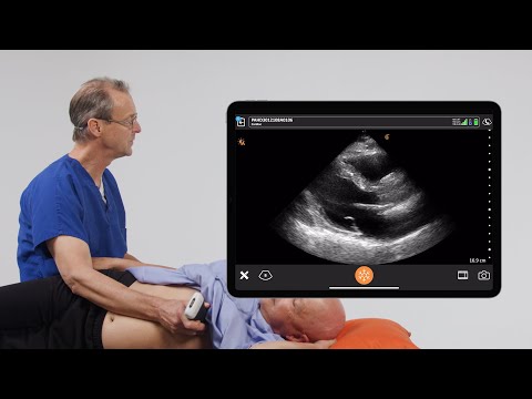 Assessing LV Function