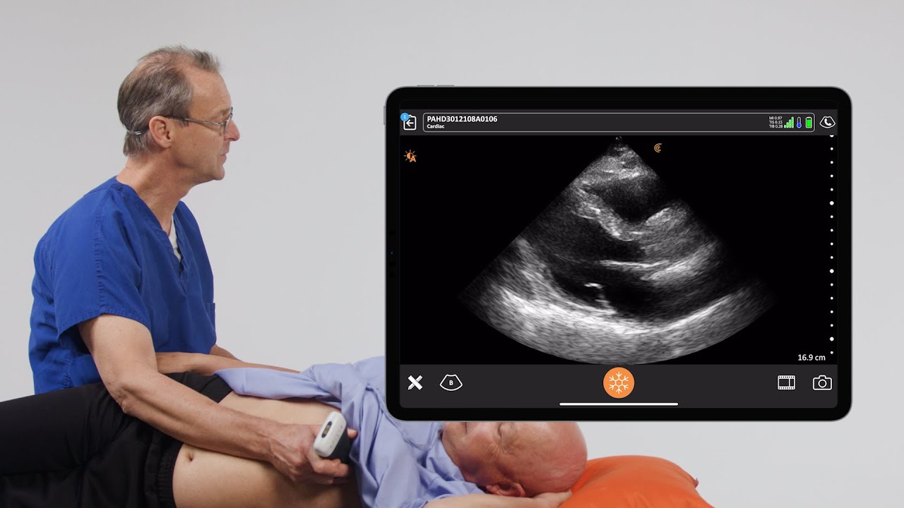 Assessing LV Function