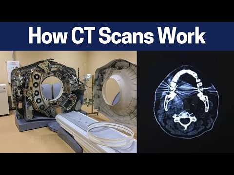 Demystifying CT Scan: How it Works in Simple Terms