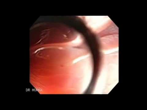 download lagu mp3 mp4 Human Parasite, download mp3 Human Parasite free download mp3, download mp3 Human Parasite