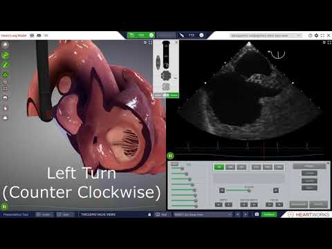 Tricuspid Valve Views Three Leaflets Five Views