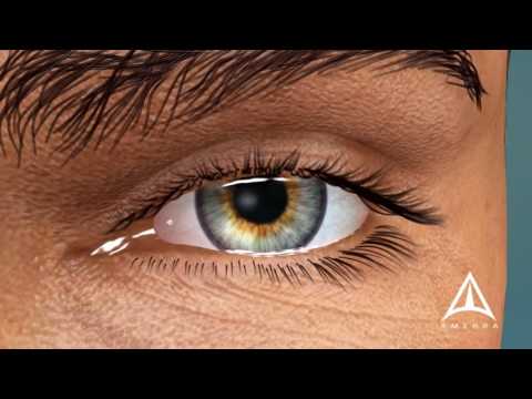 What is Macular Degeneration?