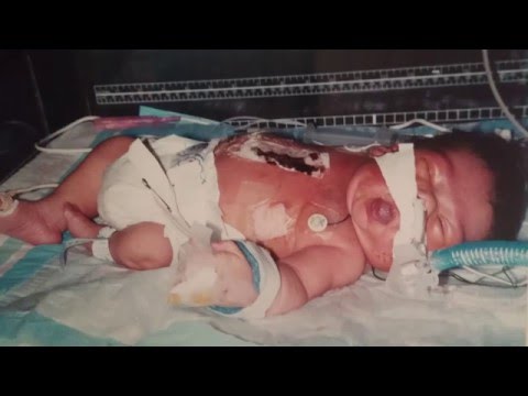 A Mother's Perseverance