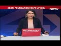 Adani Foundation To Fund Treatment Of UP Girl With Physical Disability - Video