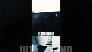 THE BEST Ultrasound Model Available #samsung #ultrasoundscan #regenerativemedicine
