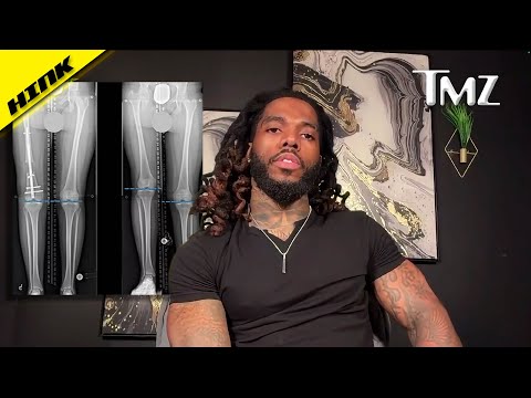 He Spent $81,000 to Gain 8 Inches...