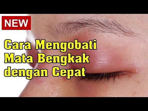 Bagaimana untuk membeli perangkat untuk pembesaran penis Harga patogen perempuan Ukraina