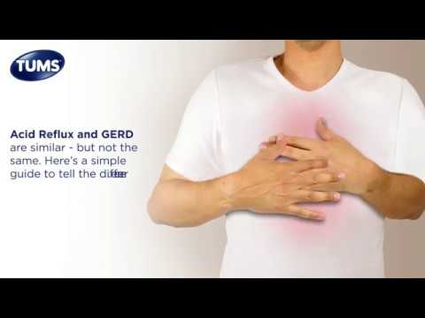 Acid Reﬂux & GERD | TUMS