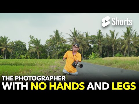 The photographer with no hands and legs