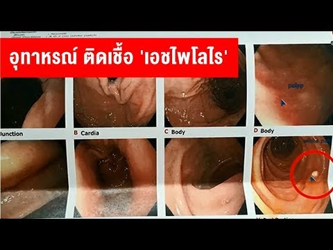 ความคิดเห็นพรูพนักงาน Call Center โนโว สิ่งที่ยาเสพติดเพิ่มความแข็งแรงของผู้ชาย