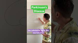 #Parkinson’s Disease | How losing #dopamine effects movement