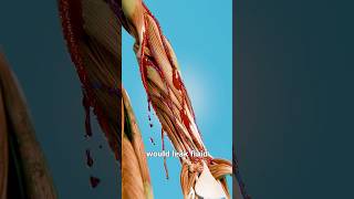What Happens If You Lose All Your Skin 😱