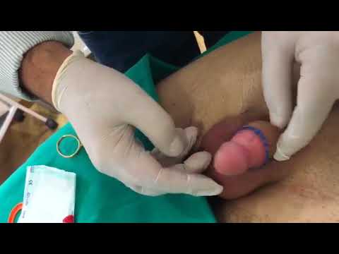 Patogen bubuk kuda Obat untuk impotensi menyembuhkan