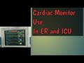 Role Of Cardiac Monitor In ER and ICU