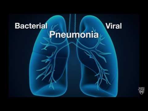 Mayo Clinic Minute: Is pneumonia bacterial or viral