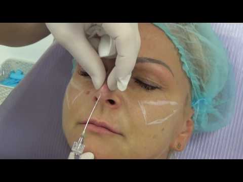 download lagu mp3 mp4 Lifting Nosa, download lagu Lifting Nosa gratis, unduh video klip Lifting Nosa