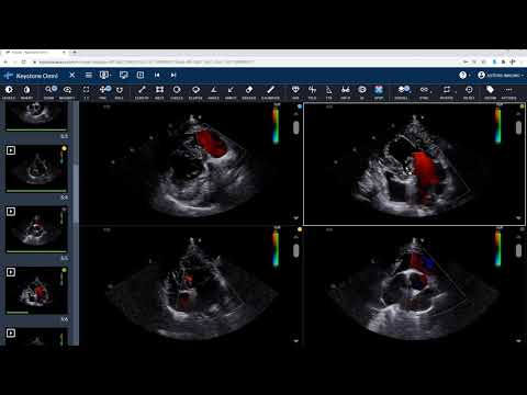 Cineloops Player | Veterinary Image Management Software | Keystone Omni