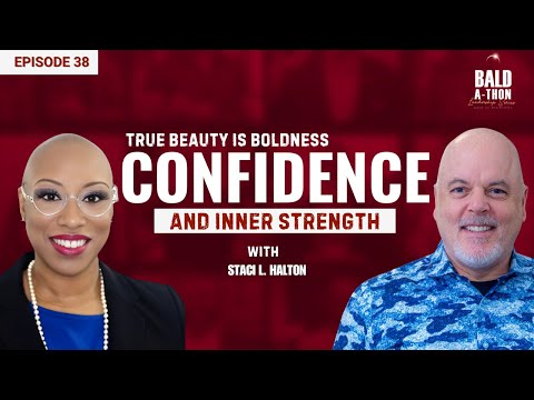 Alopecia Queen Movement | Bald-A-Thon Ep. 38 | Success Story Podcast