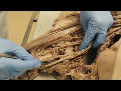 Nerven des Plexus brachialis schnell und einfach finden - Sezierkurs Live Tag 27