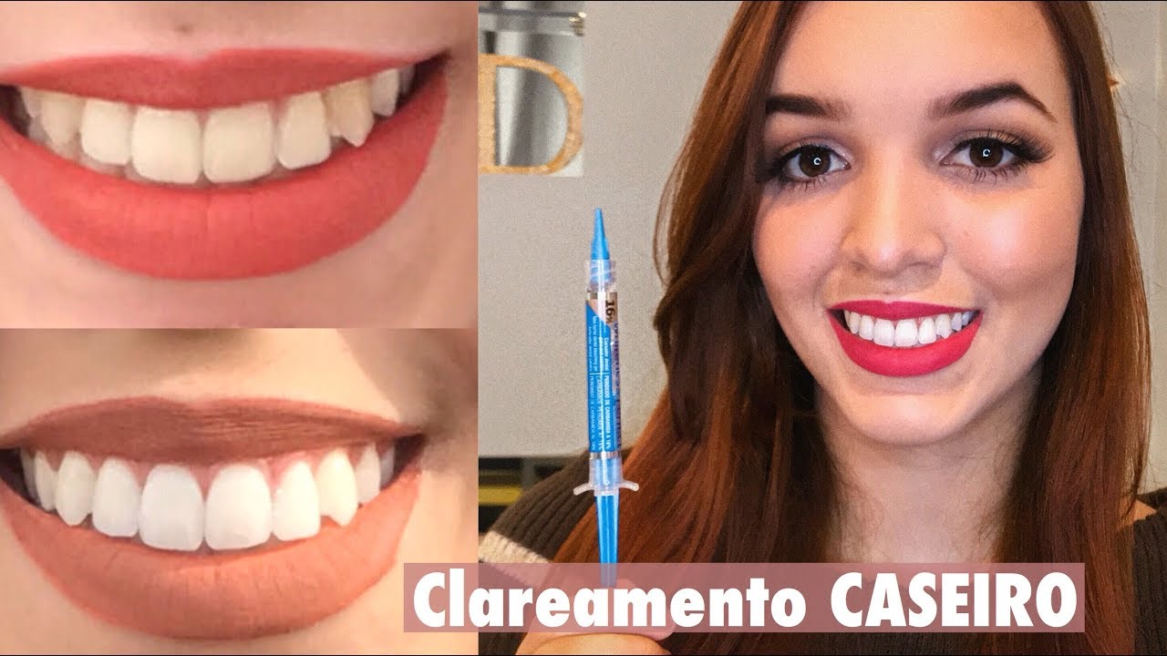 Clareamento Dental CASEIRO - WHITENESS PERFECT | Debora Freitas