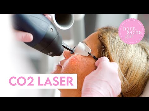 Hautverjüngung mit dem CO2-Laser | Dr. Barbara Franz