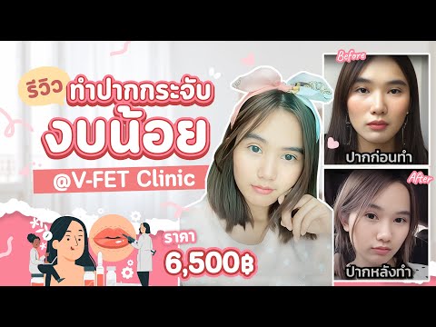 ทําปากกระจับ
