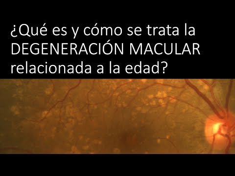 ¿Qué es y cómo se trata la degeneración macular relacionada a la edad?