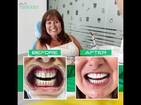 dentasey video