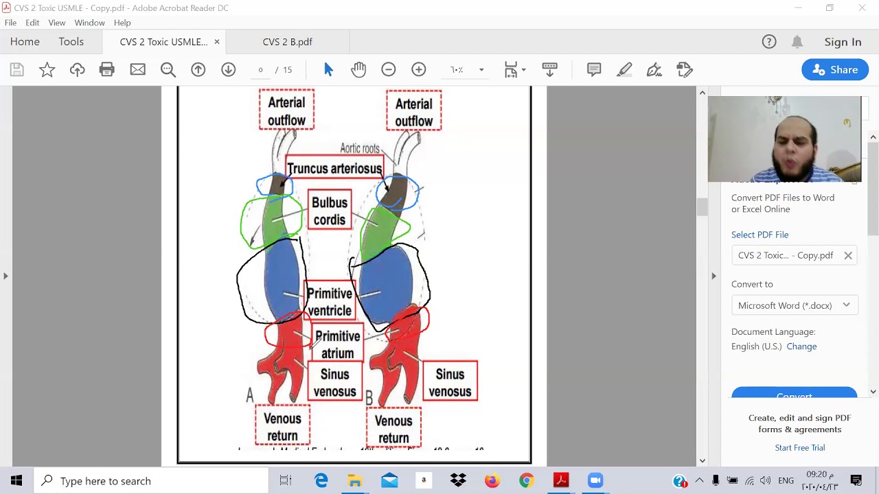 USMLE cardio vacular 2  (DR Ibrahem Gamal - TOXIC USMLE ) د ابراهيم جمال -المعادلة الامريكية