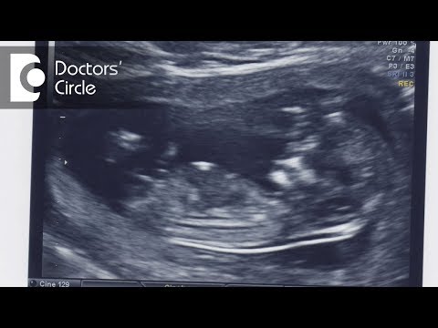What is a normal nuchal translucency measurement?-Dr. Geeta Komar