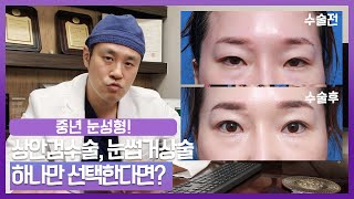 안검 수술, 성형 안과와 성형 외과 중 어느 쪽이 더 적합할까요? | 새빛안과 성형 안과 전문의가 알려드리겠습니다
