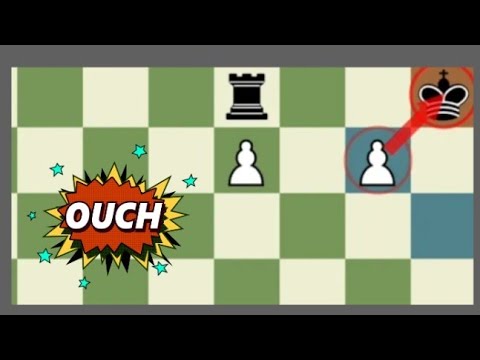 Magnus Carlsen unbelievable and heart-stopping chess game (must watch)