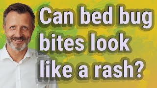 Can bed bug bites look like a rash