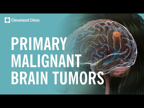 What Are Primary Malignant Brain Tumors?