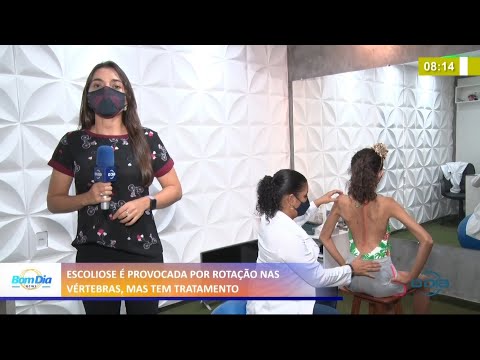 Escoliose, doença provocada por rotações das vértebras na coluna, tem tratamento 11 03 2021
