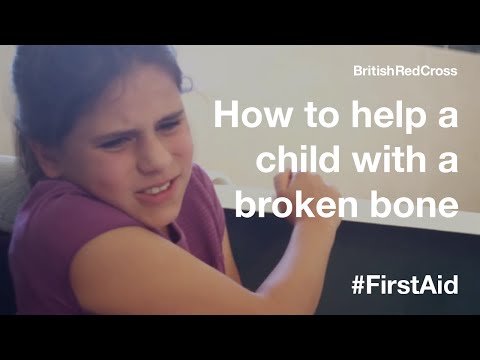How to help a child with a broken bone #FirstAid #PowerOfKindness