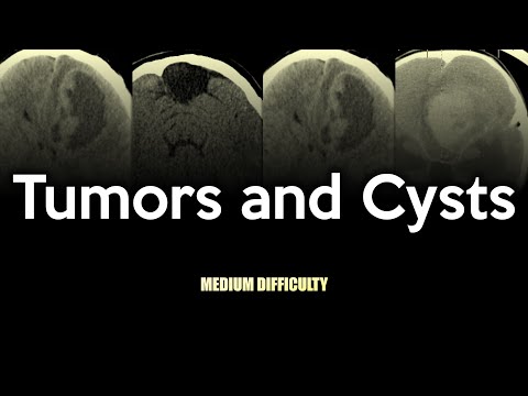 Brain Tumors and Cysts CT Quiz: Medium Difficulty